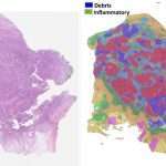 Cellular community detection for tissue phenotyping in digital histology images