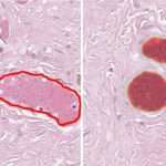 Segmentation of micro-vessels and nerves in digital histology images